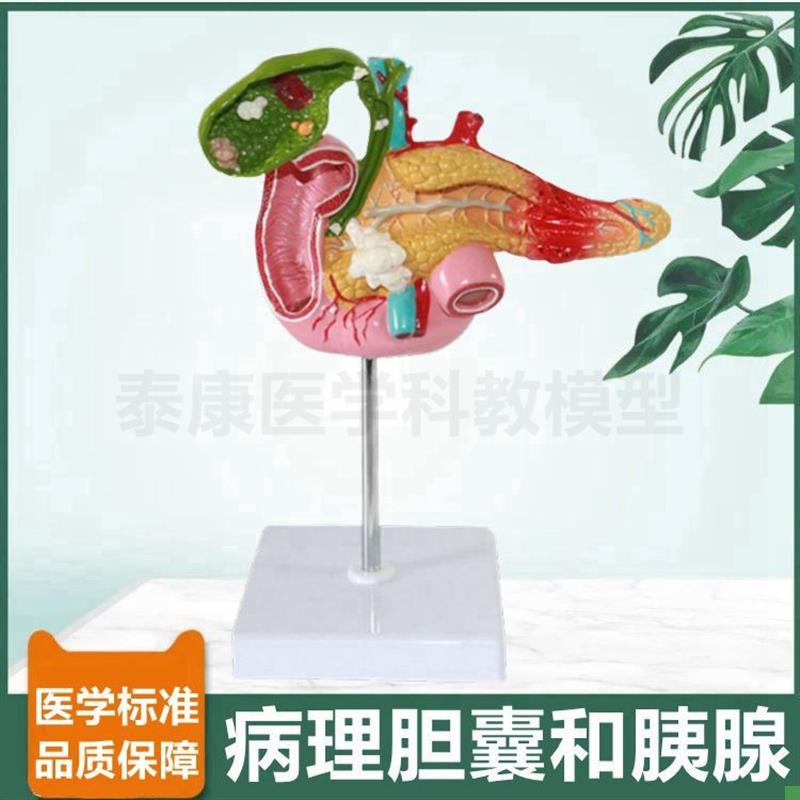 病理胆囊模型胰腺十二p指肠消化器官脾脏肝脏肝总管动静脉人体肝