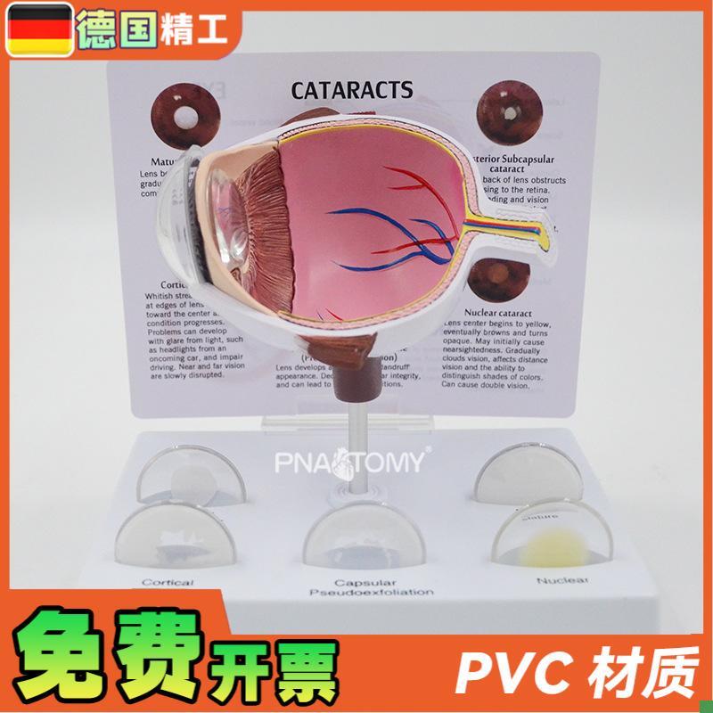 德国】眼球模型病理眼球演t示教具眼科展示礼品人体器官解剖模型