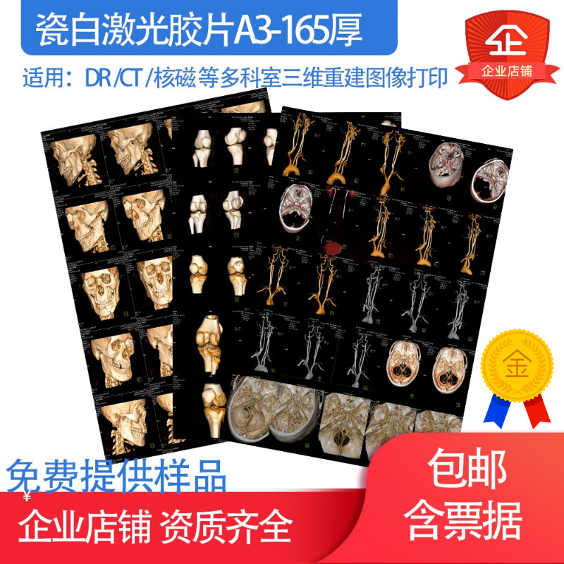 瓷白激光喷墨胶片彩色ct三维重建dr cr 打印胶片a3/13*17