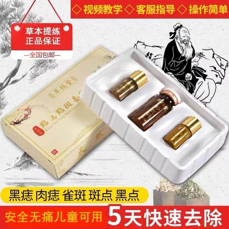 点黑痣膏无痕正品脸部祛肉痣药水美容院去除痦子痣去雀斑药水