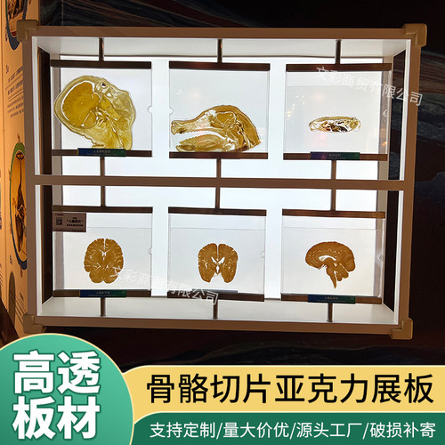 昆虫标本亚克力翻转板博物馆展品