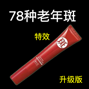 正品去斑霜去老年斑黑色素专用脸部去手上手部手背的药膏强力去除