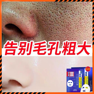 波斯顿男士面膜控油补水保湿收缩毛孔粗大修复脸部专用波士顿春夏