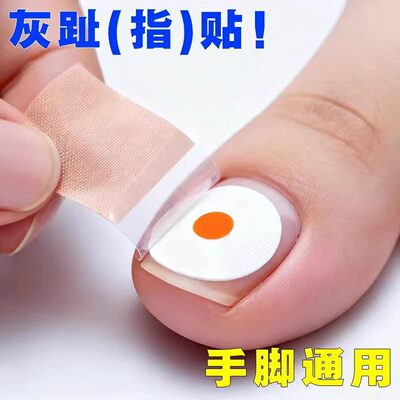 【断货王】灰趾增厚正品专用灰指贴发黄粉碎甲脚趾手指甲专用