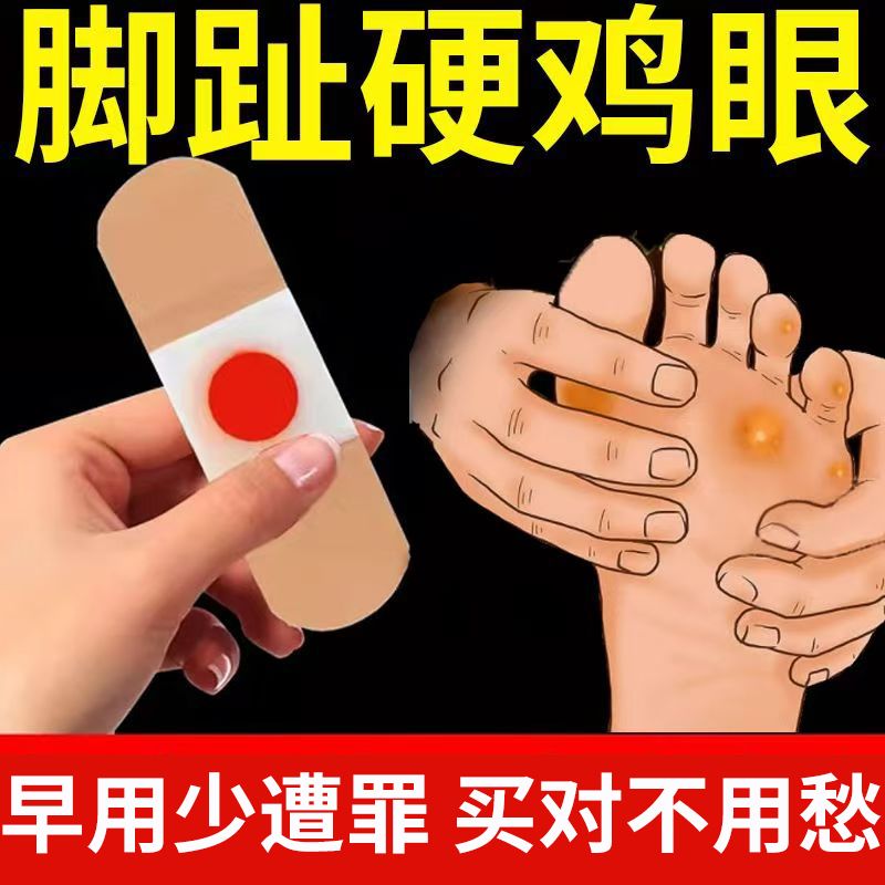鸡眼贴鸡眼膏老茧肉刺肉粒脚丁瘊子跖尤刺窝死皮脚垫趾底手足专用