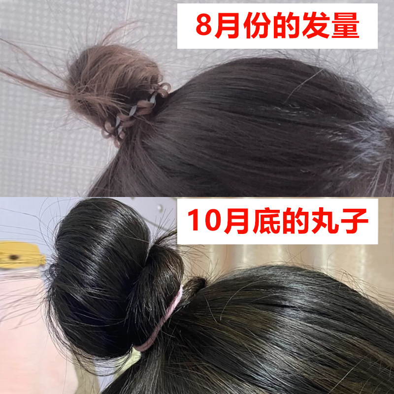 L] Sphere/ Ketoprofen[Renhe hair care liquid]Hair natural Growth rate changeablein the Makeup/Perfume/Beauty tools , Other Beauty Tools , Makeup/Beauty Tools  category - from Buy2taobao.com to provide professional Taobao agent buy service