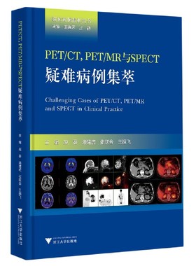PET/CT PET/MR与SPECT疑难病例集萃编者:赵葵//潘建虎//张联合//