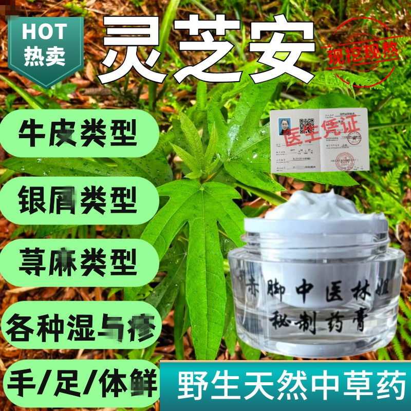 灵芝安药膏湿牛皮癣银屑病顽固皮炎皮肤痒泡疹丘疹适大人小孩