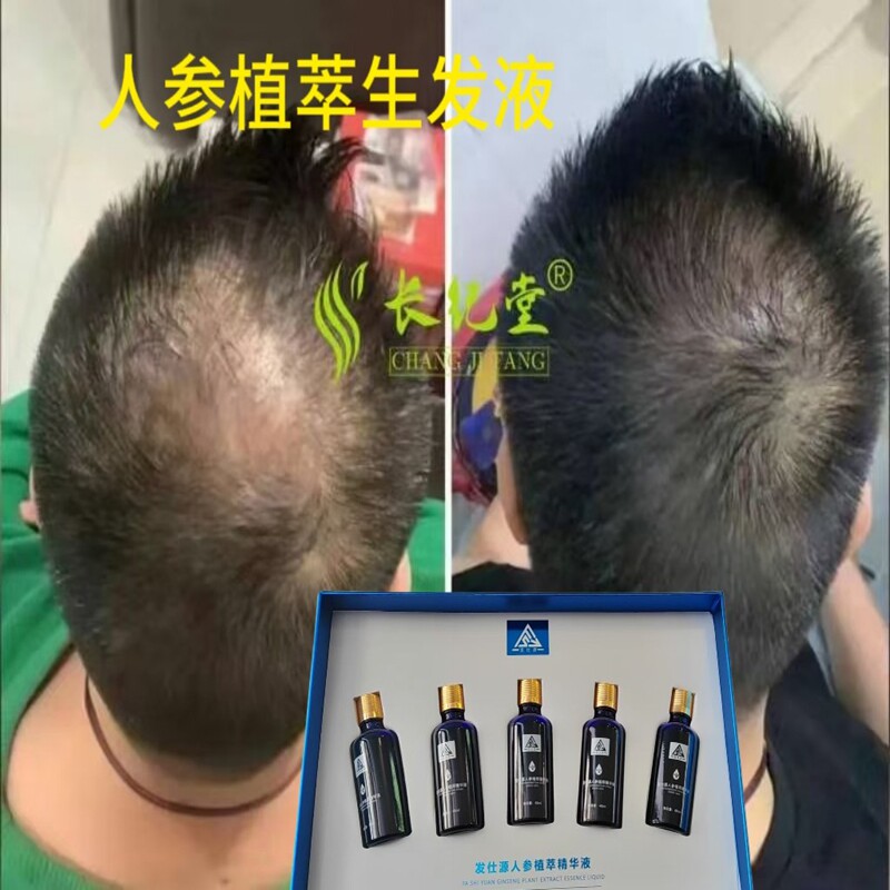 人参植萃精华液生发养发纯植物生发植萃精华液密发增发精华液正品