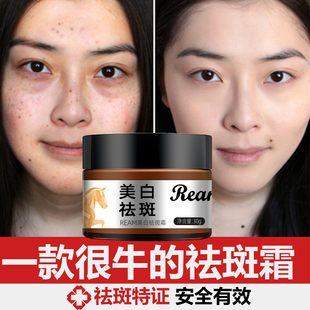 日本美白祛斑霜淡斑去老年斑雀斑黄褐斑妊娠斑晒斑脸部手背正品