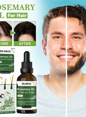 Hair care rosemary oil for hair care, strong and resilient