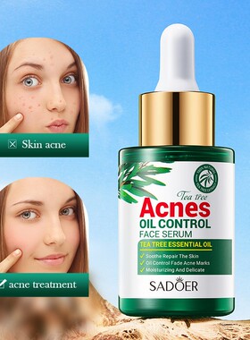 Tea Tree Acne Repair Face Serum Scar Treatment Oil Control液