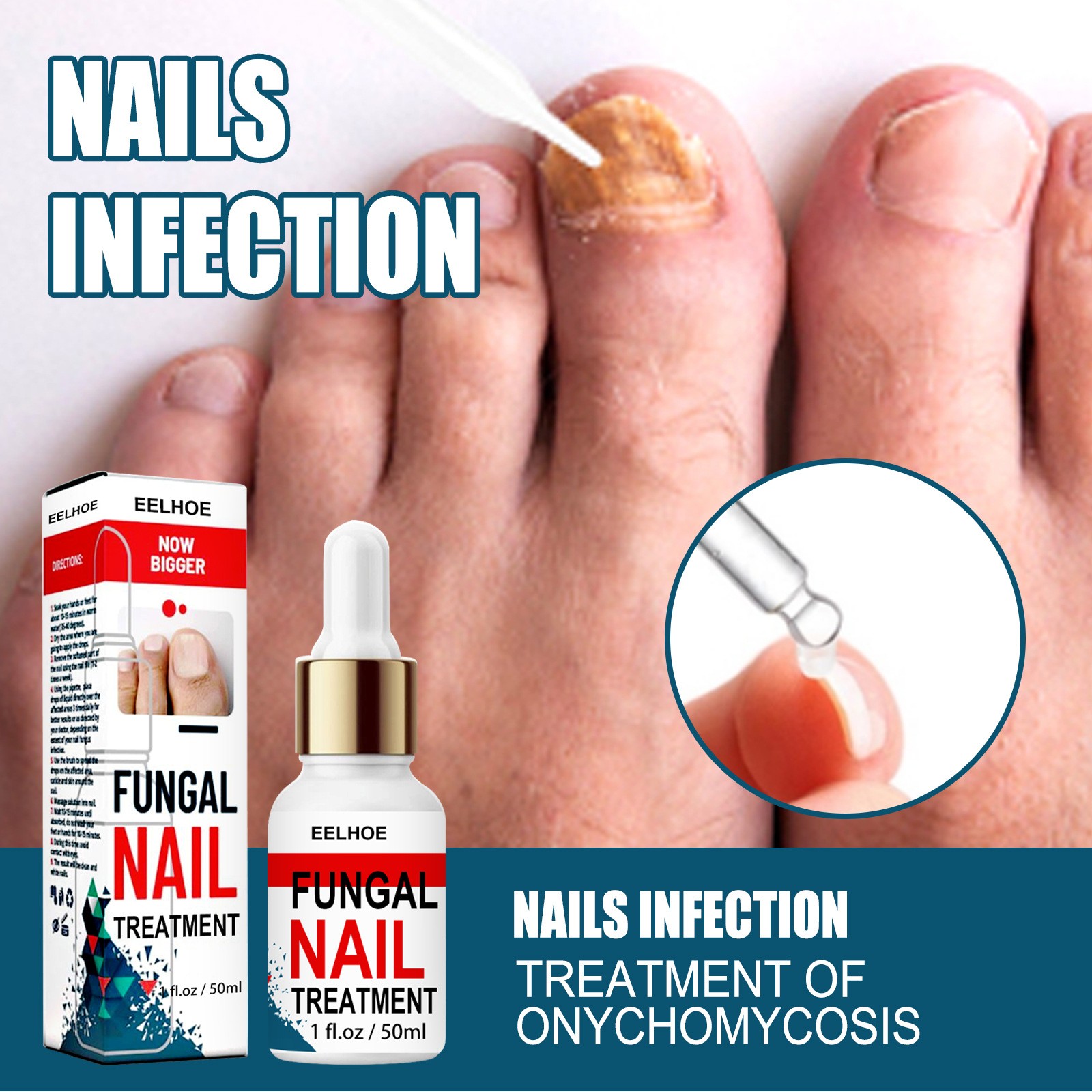 Nail Fungus Treatment Essence Serum Care Hand and Foot Care