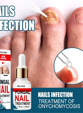 Nail Fungus Treatment Essence Serum Care Hand and Foot Care