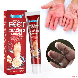 Feet Cracked Cream Feet Dry Crack Anti-freezing Crack Cream