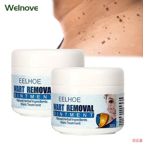 30g Skin Tag Remover Cream Warts Mole Remove Ointment Antiba