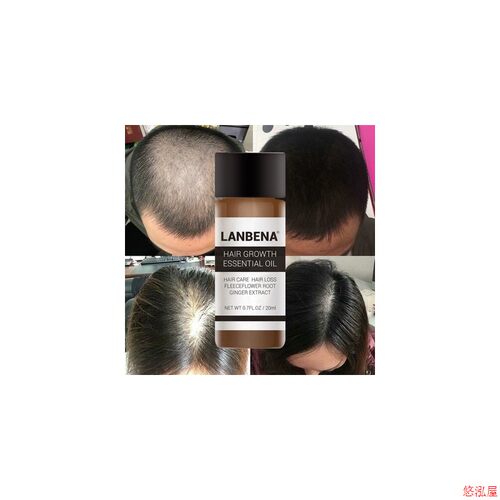 LANBENA 蓝蓓娜 Hair Growth Essential Oil 头发护理精油 20ml