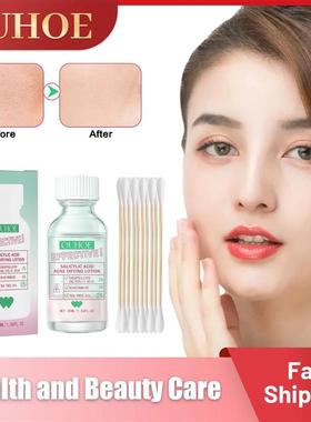 Salicylic Acid Acne Removal Serum Pimples Treatment Anti Whi
