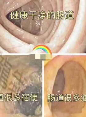 排宿便清肠垢辟谷酵素
