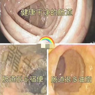 藤黄果肠排排肠垢清便综合台湾原料果蔬酵素粉一天轻断食辟谷代餐