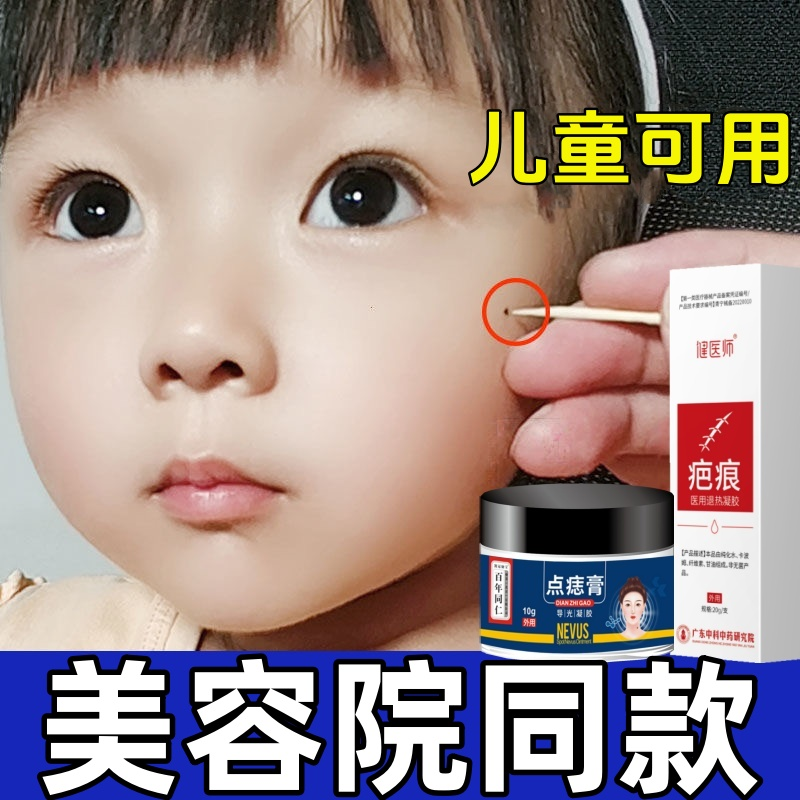 点痣膏去痣点痣无痕正品旗舰店不留疤去黑点肉痣脸部专用神器