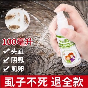 虱子药去儿童头虱除阴虱百部酊虱立净灭虱卵跳蚤小女孩头发一扫光