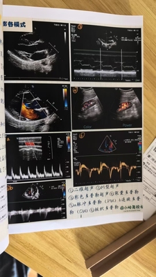 超声笔记医学诊断b超彩超入门掌上规培结业考手写笔记打印A4纸质