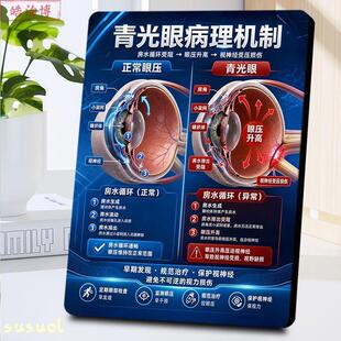 青光眼病理机制科普相框摆台眼科医院视神经保护眼压健康装饰摆件