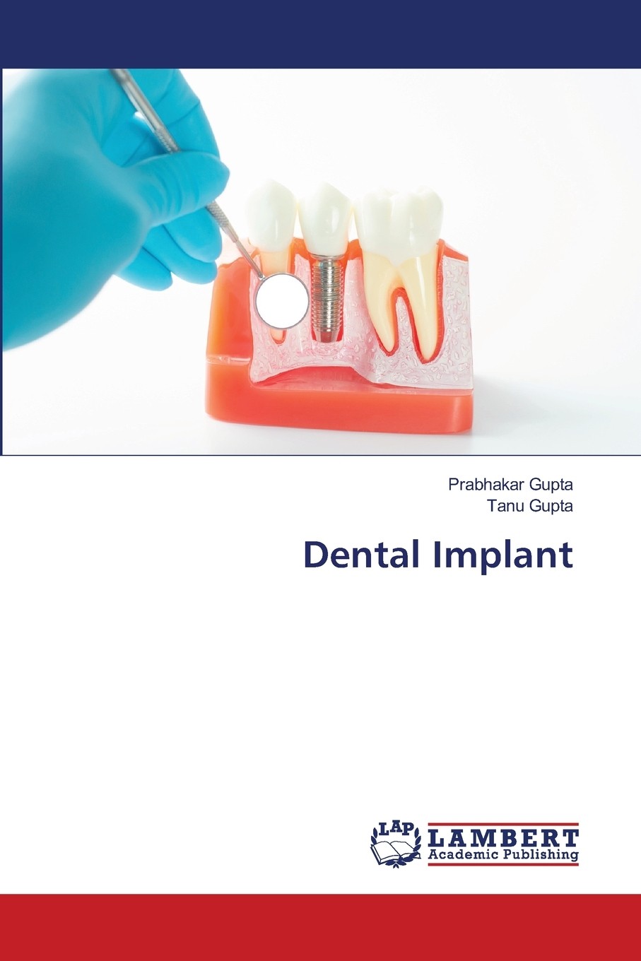 【预售 按需印刷】dental implant