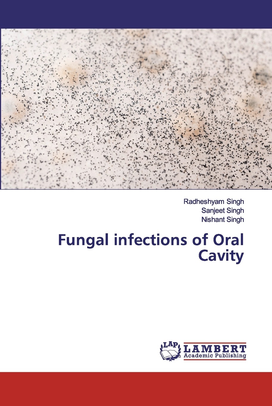 【预售 按需印刷】fungal infections of oral cavity