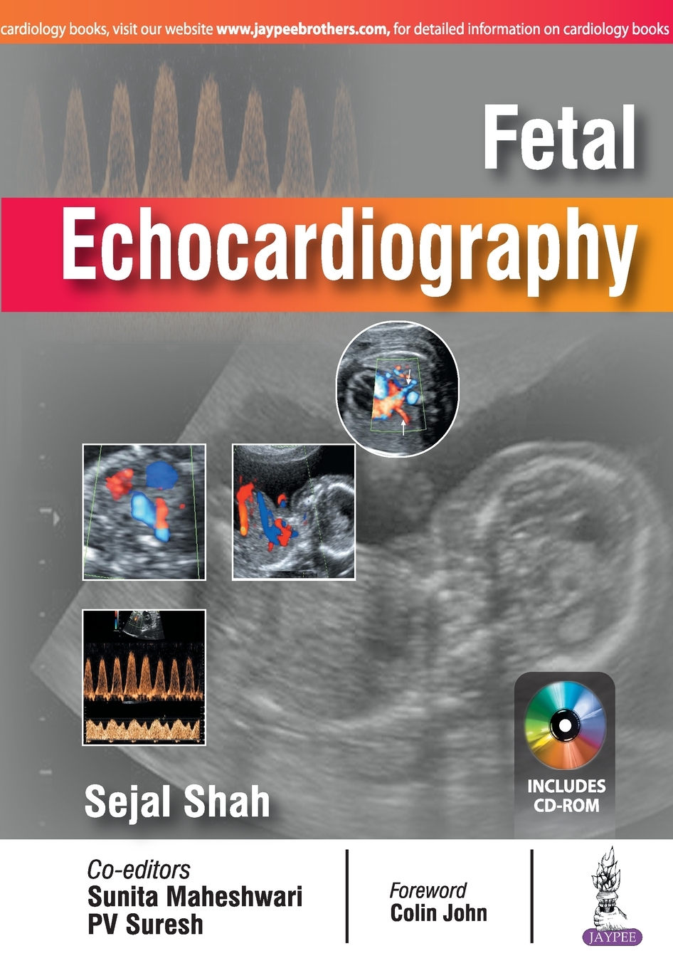 【预售 按需印刷】Fetal Echocardiography 书籍/杂志/报纸 生活类原版书 原图主图