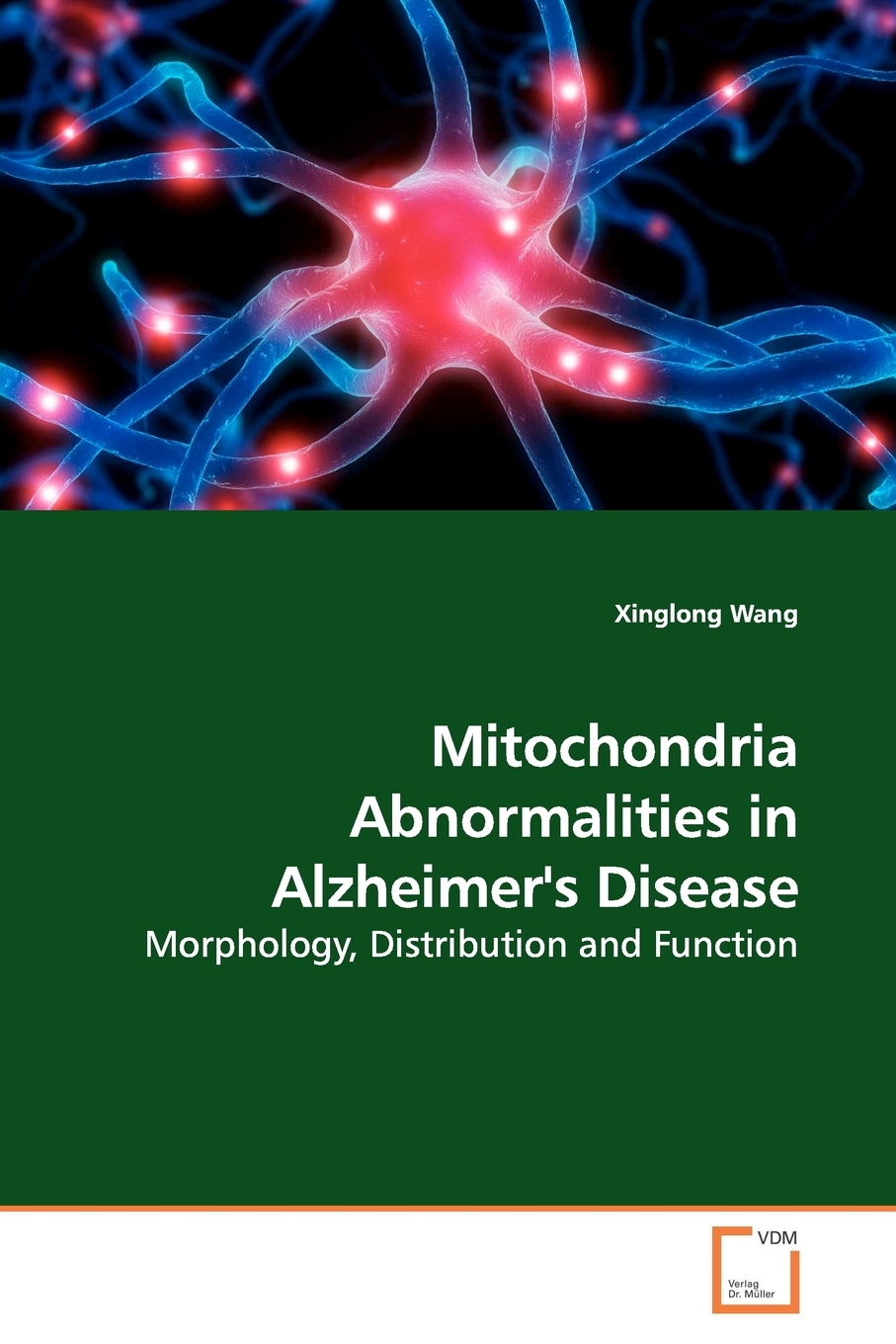 【预售按需印刷】Mitochondria Abnormalities in Alzheimer s Disease