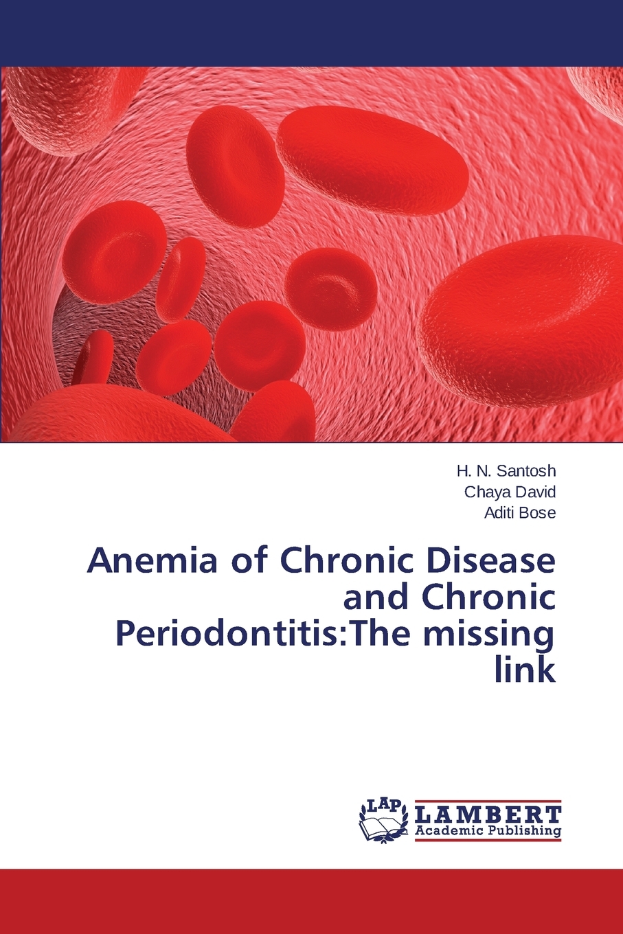 【预售 按需印刷】Anemia of Chronic Disease and Chronic Periodontitis 书籍/杂志/报纸 原版其它 原图主图