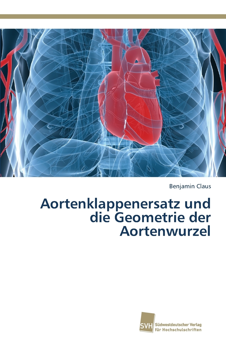 预售 按需印刷 Aortenklappenersatz und die Geometrie der Aortenwurzel德语ger 书籍/杂志/报纸 原版其它 原图主图