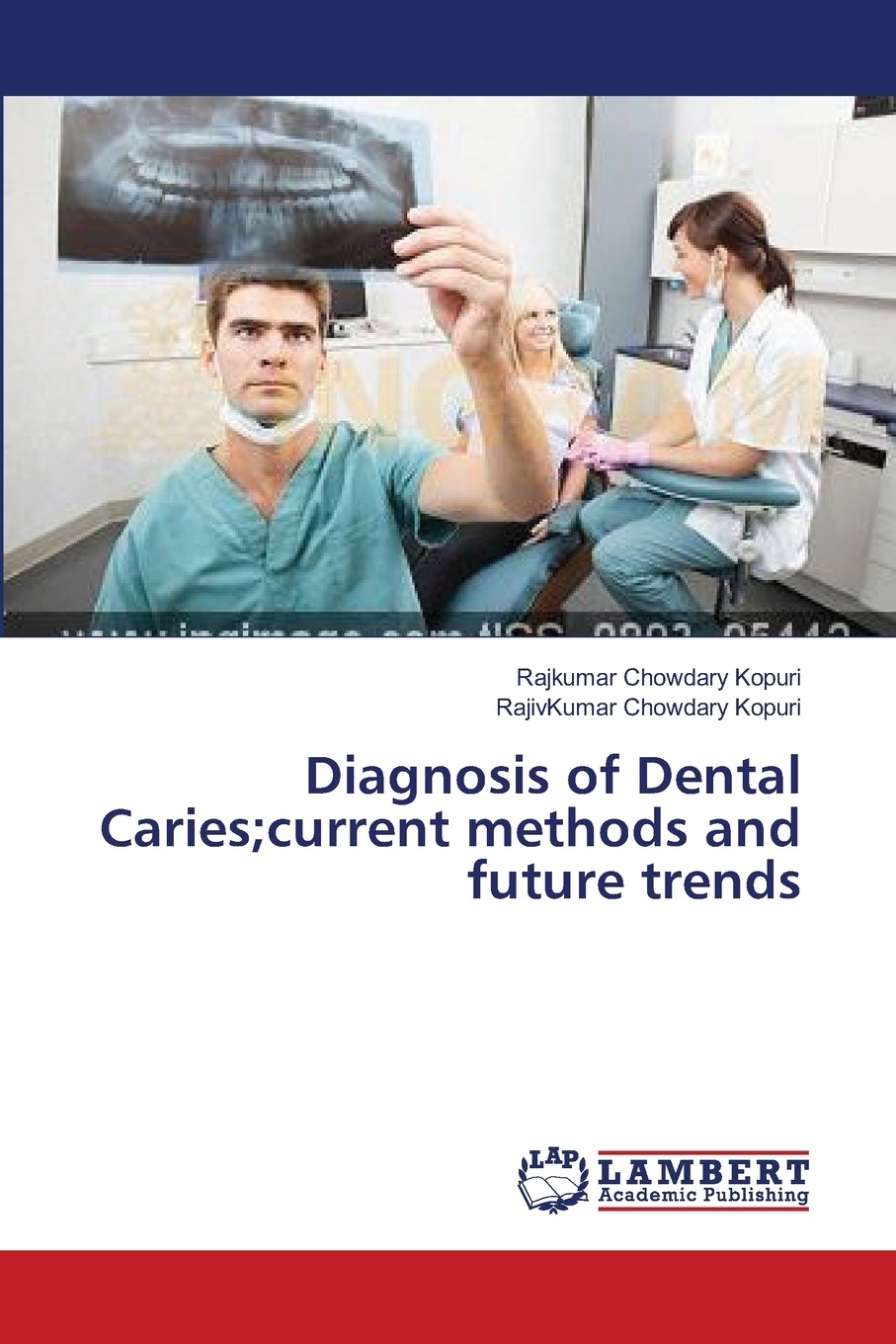 预售 按需印刷 diagnosis of dental caries;current methods and