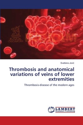 预售 按需印刷 Thrombosis and anatomical variations of veins of lower extremities