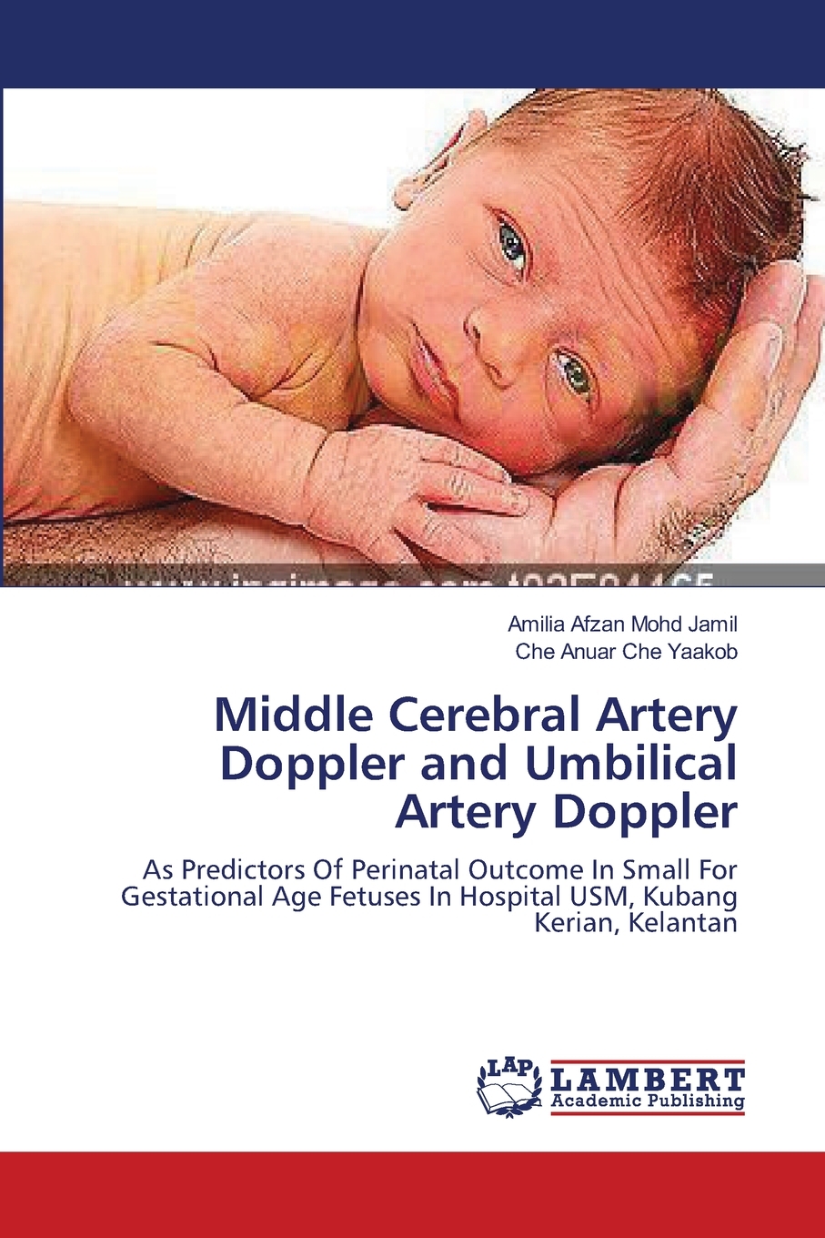 【预售按需印刷】Middle Cerebral Artery Doppler and Umbilical Artery Doppler