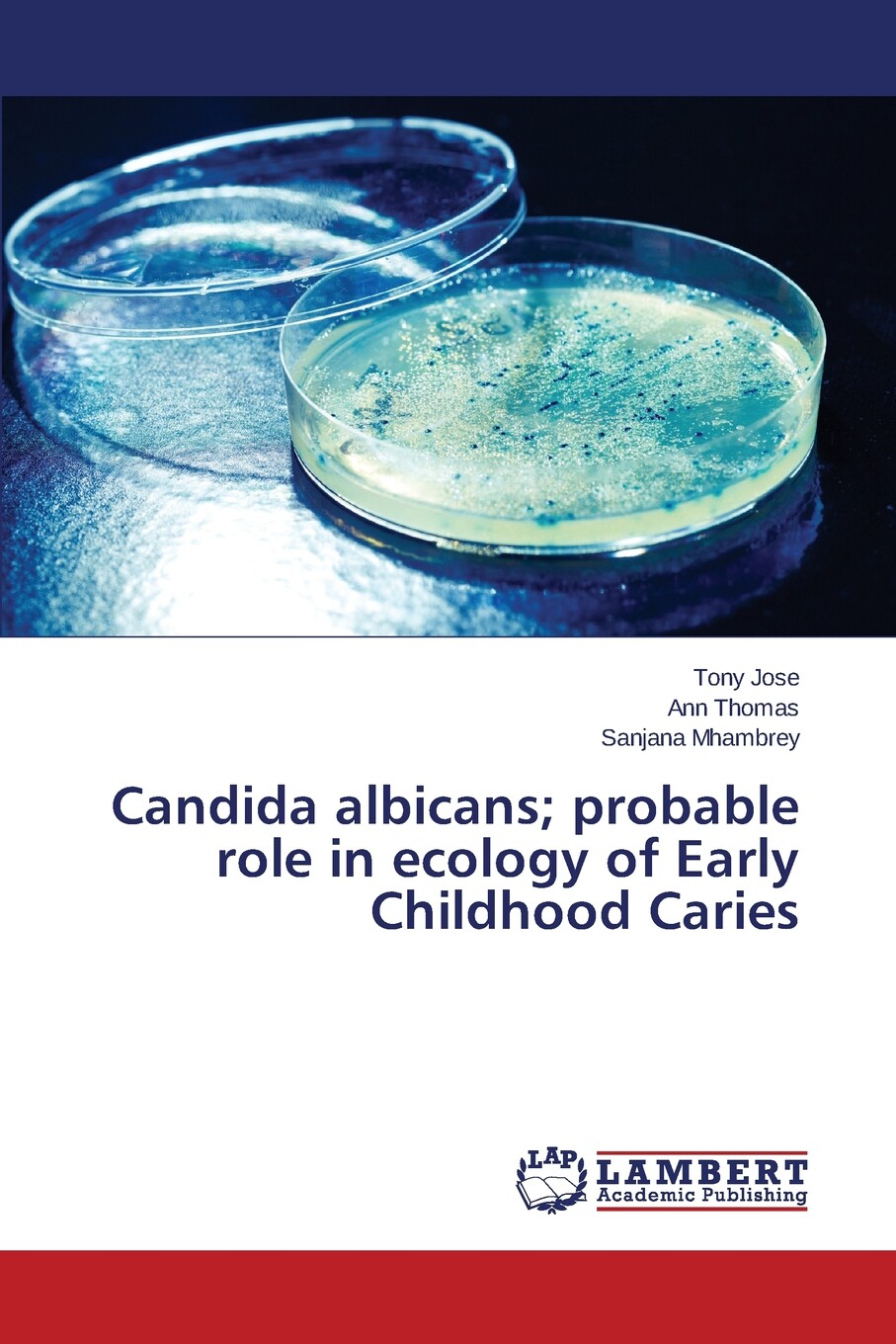【预售 按需印刷】candida albicans; probable role in ecology of
