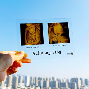 宝宝四维纪念透明相框摆台nt彩超b超孕期记录照片定制相片diy礼物