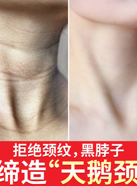 颈膜紧致去颈纹淡化细纹护理脖膜抗皱玻尿酸补水OEM加代工美容批