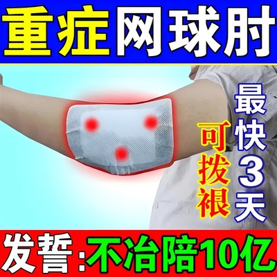 网球肘专用药药膏克星治疗特效重症胳膊手肘关节疼痛护肘狸米凝胶
