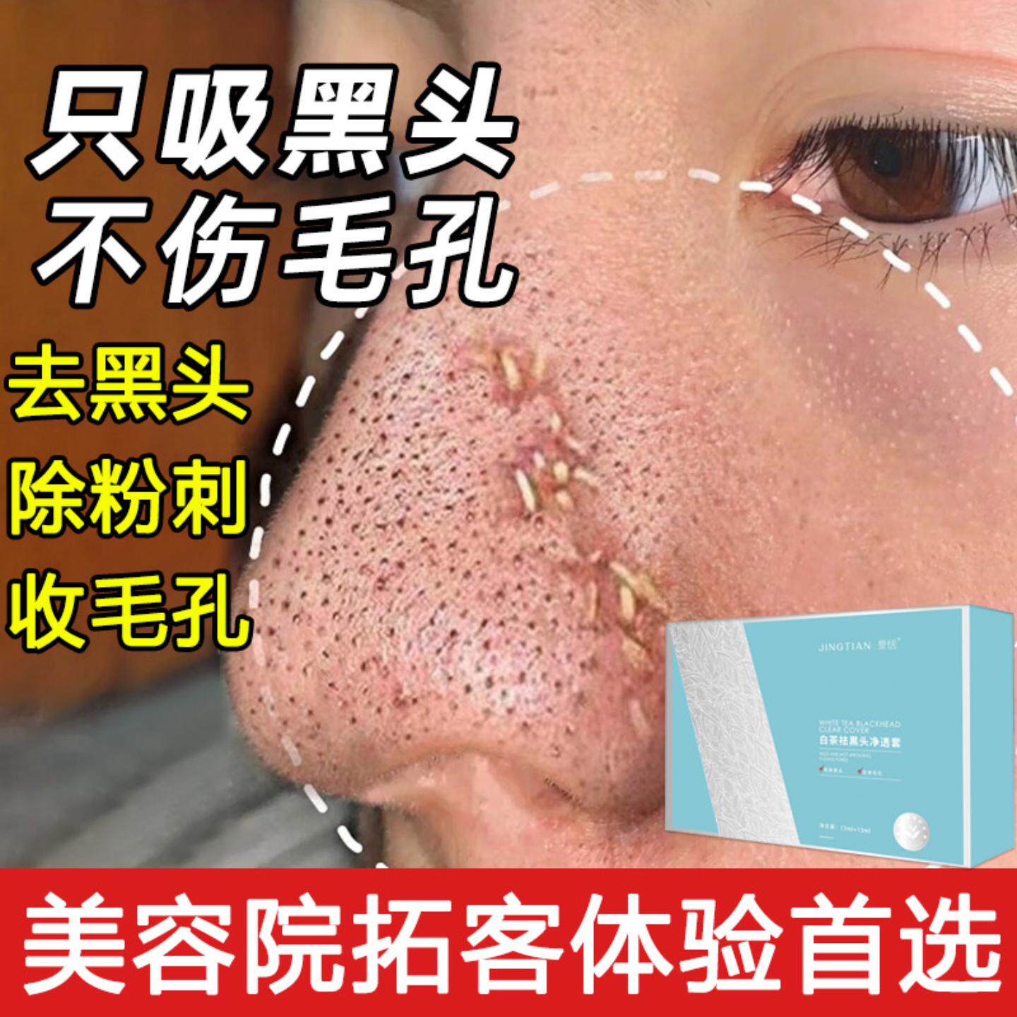 去黑头鼻贴套盒厂家温和祛闭口