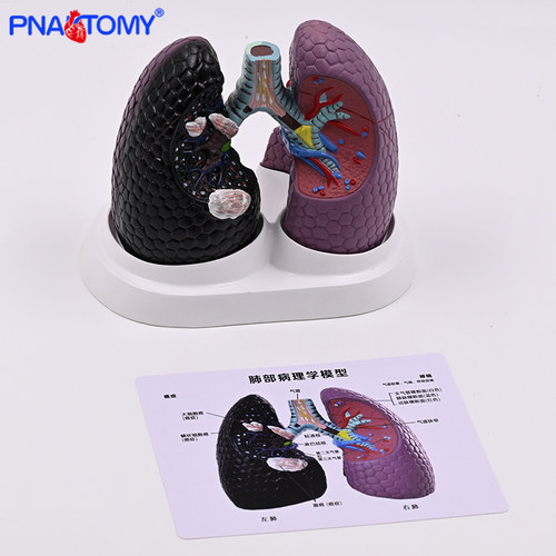 普奈特正常肺吸烟病理肺对比教具