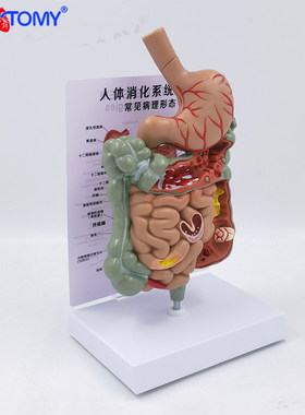 PNATOMY病理消化系统模型医学用