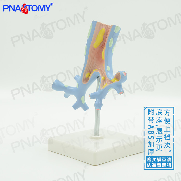 正品人体呼吸系统肺支气管树病理解剖模型教学医用呼吸科标本
