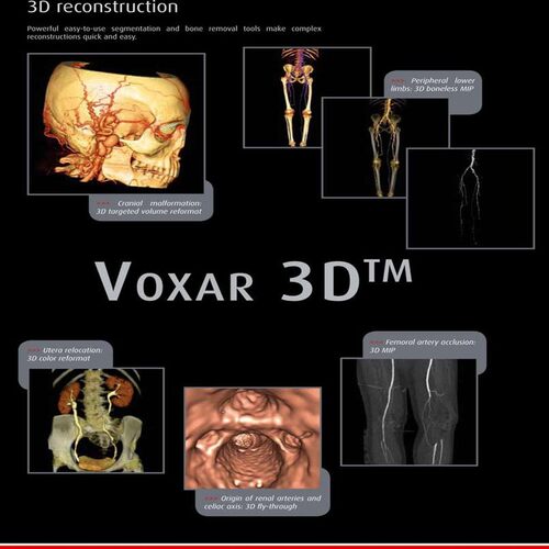 BarcoVoxar3D5.1重建三维