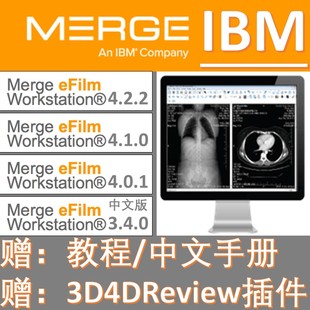 eFilm医学影像放射看图可打印eFilm Workstation DICOM DCM IMA