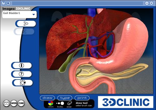 人体三维解剖软件 3Dclinic Software（免安装直接用已注册）