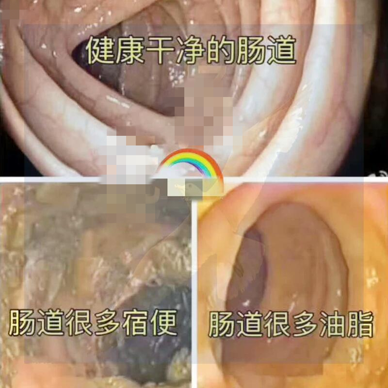 酵素肠排套盒礼盒装顺畅