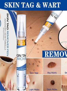 Skin Tag Remover Agat Moles 12 Hours Fast Removal Genital Wa